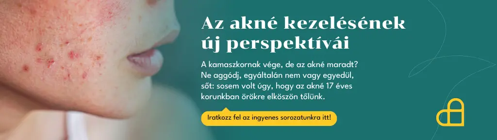 Akné hírlevél sorozat